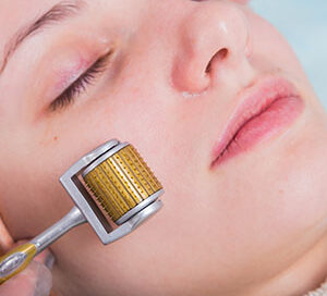 medical skin needling