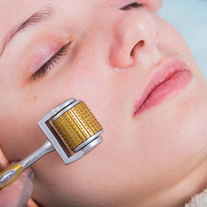 How Medical Skin Needling Can Revitalize Your Skin