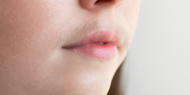 Embracing facial hair treatment