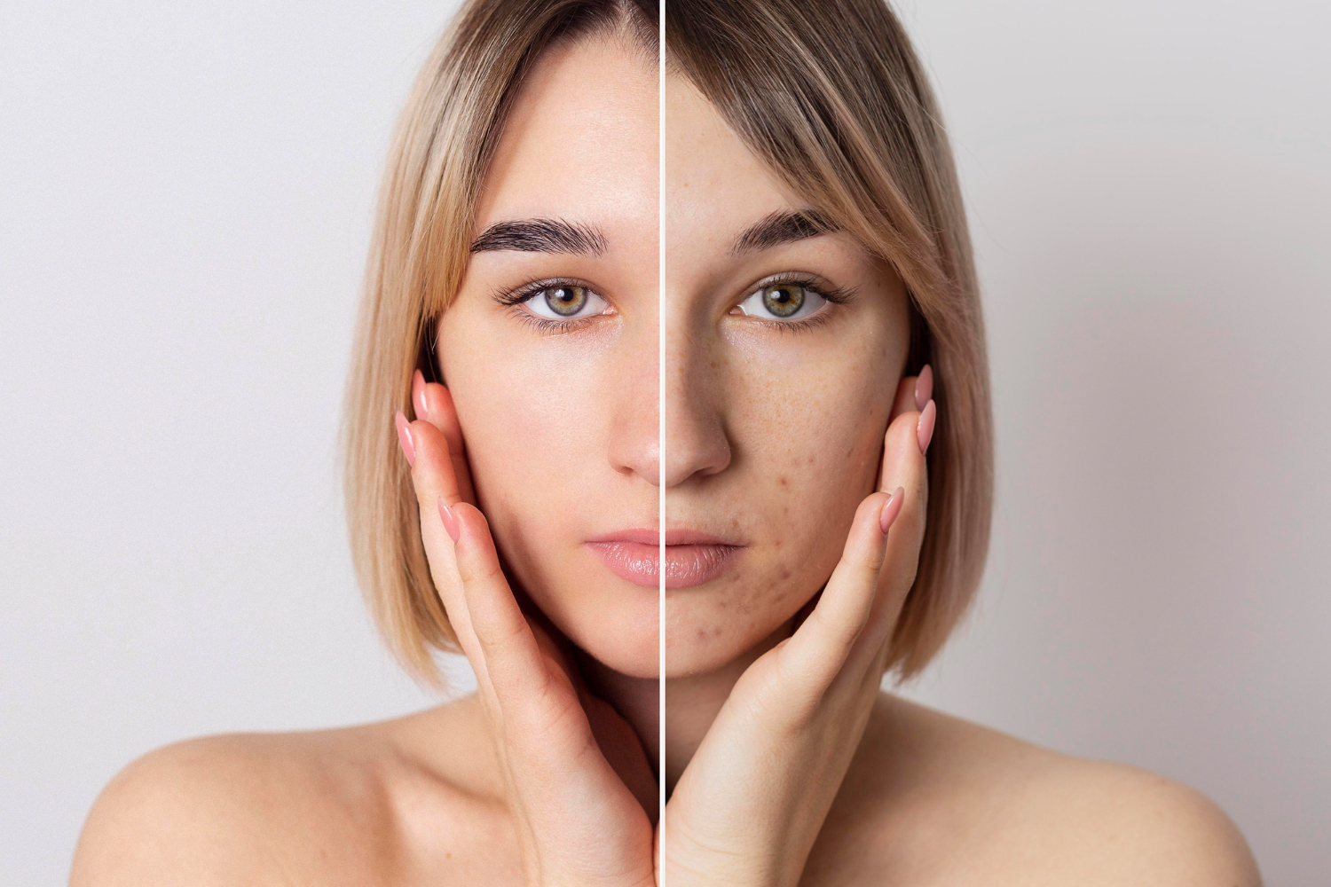 Pigmentation treatment comparison