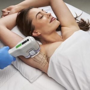 miraDry precisely delivers thermal energy to eliminate sweat and odour glands for good.