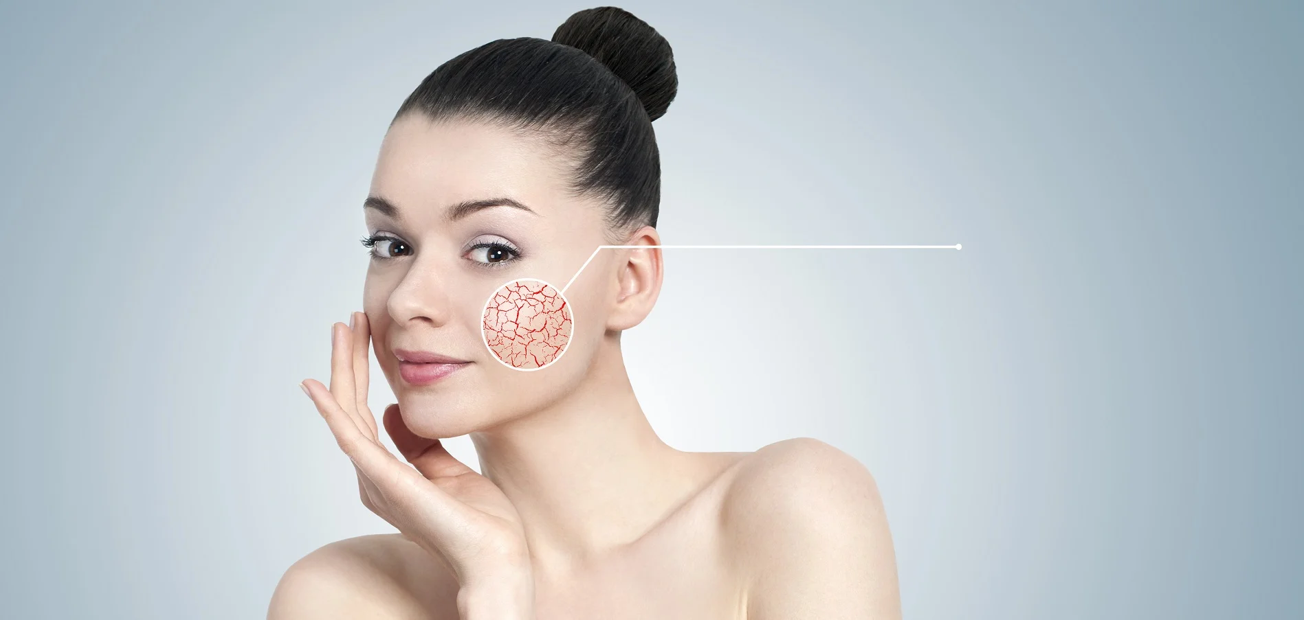 Laser vein treatment analysis