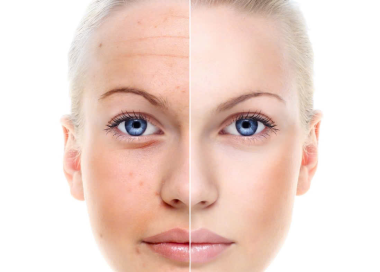 Medical microdermabrasion comparison