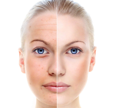 Medical microdermabrasion comparison